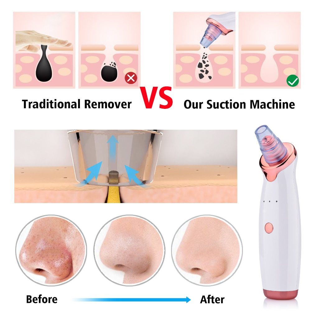 Viral TIKTOK Blackhead Beauty Instrument Electric Suction