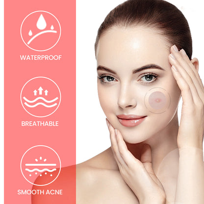 Cute Star Pimple Patches – Hydrocolloid Acne Stickers for Face, Zits & Blemish Cover