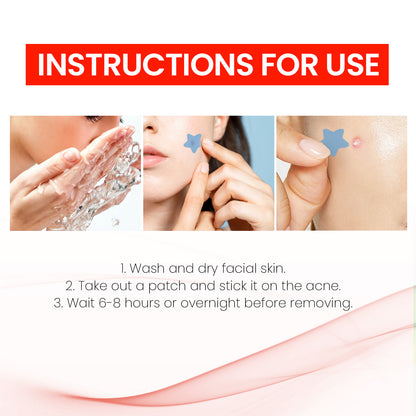Cute Star Pimple Patches – Hydrocolloid Acne Stickers for Face, Zits & Blemish Cover