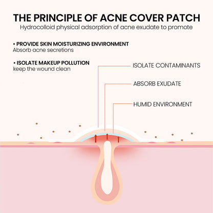 Cute Star Pimple Patches – Hydrocolloid Acne Stickers for Face, Zits & Blemish Cover